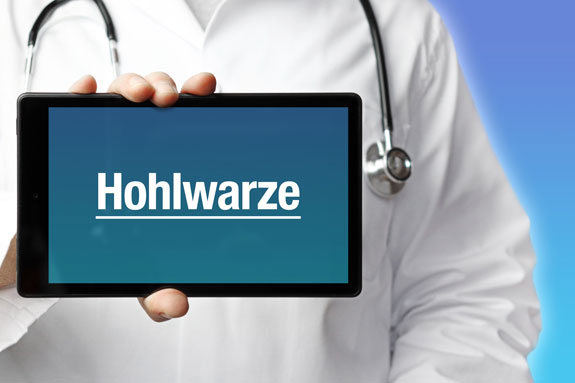 Eingezogene Brustwarzen Freising